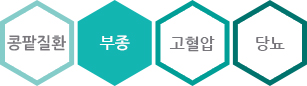 부종체크