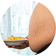 부종증상4